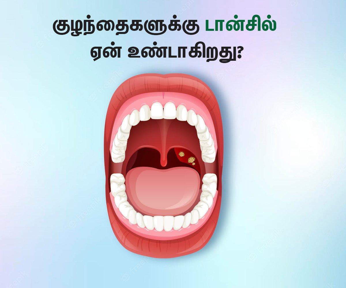 Tonsillitis Symptoms