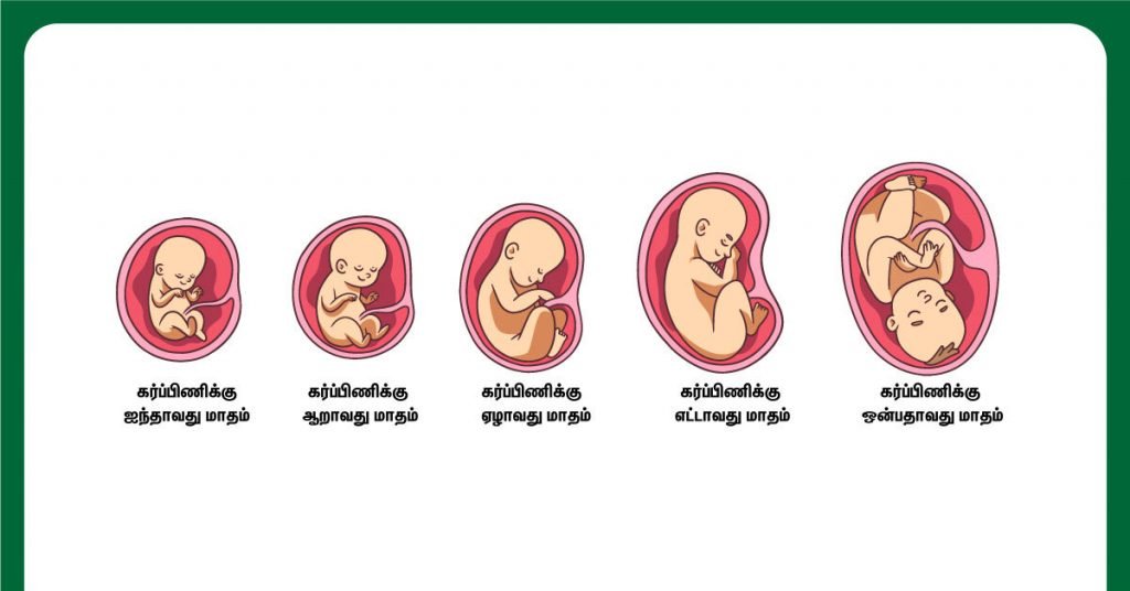 கரு வளர்ச்சி குறைபாடு (Fetal Growth Retardation in Tamil) காரணங்கள், அறிகுறிகள், தீர்வுகள் என்ன! 3 fetal development week by week