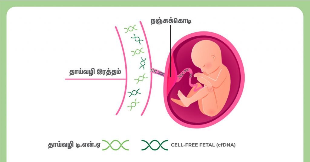 டவுன் சிண்ட்ரோம் பற்றிய முழுமையான விளக்கம்! 6 Non-invasive prenatal test