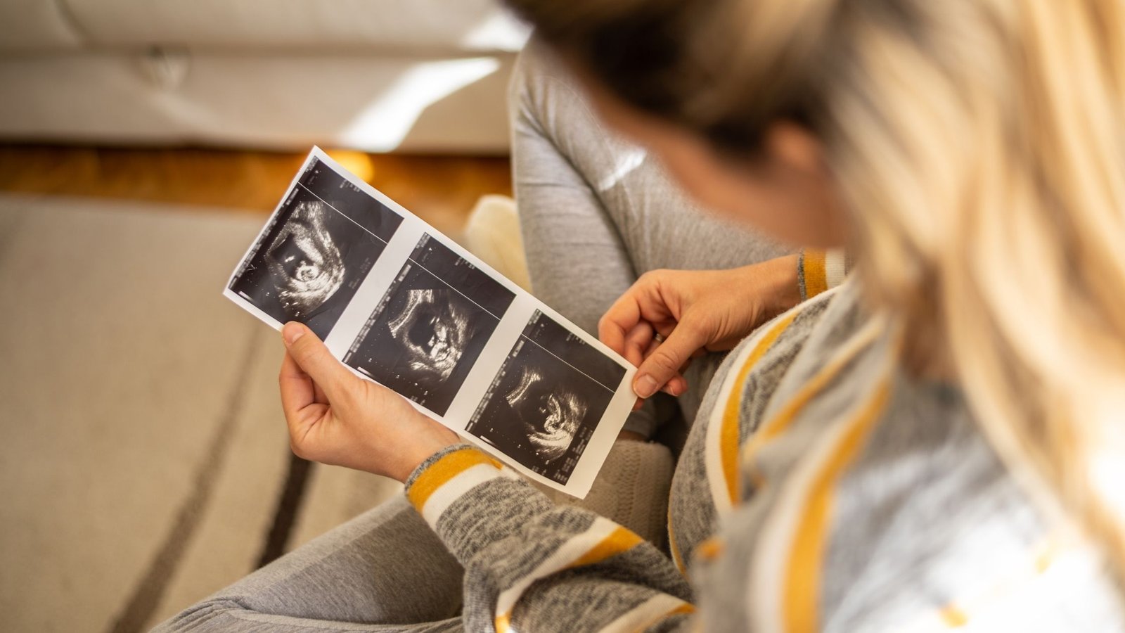 NT scan during pregnancy