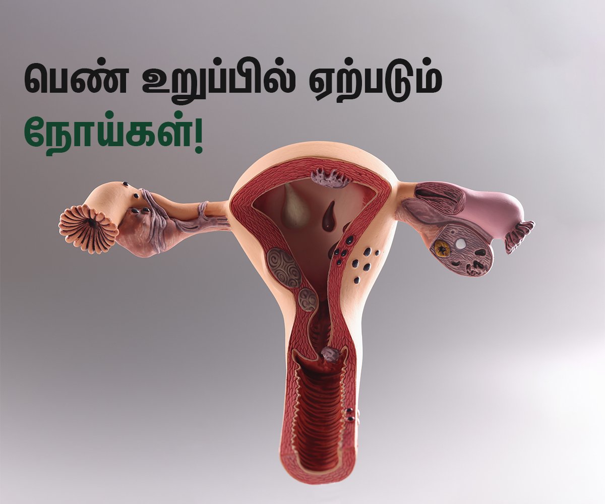 Common Vaginal Problems