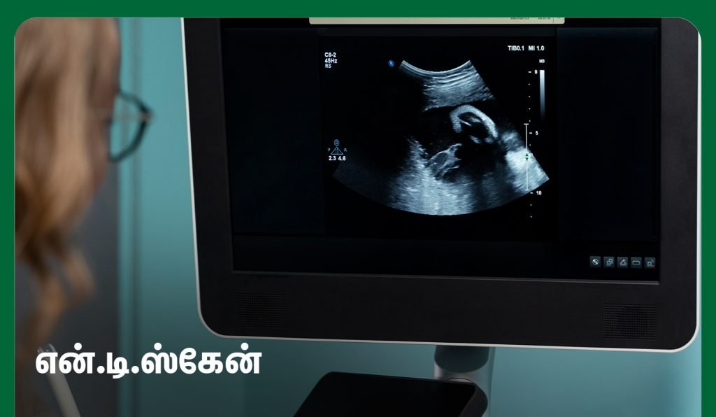 first trimester NT scan