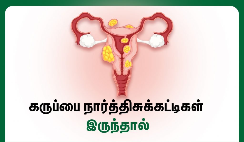Fibroids