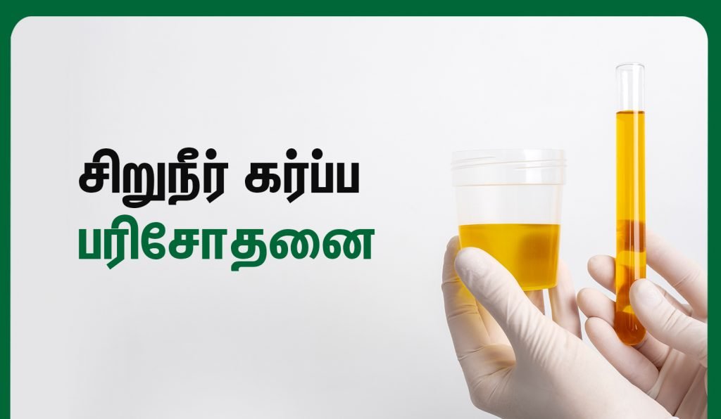 urine pregnancy test