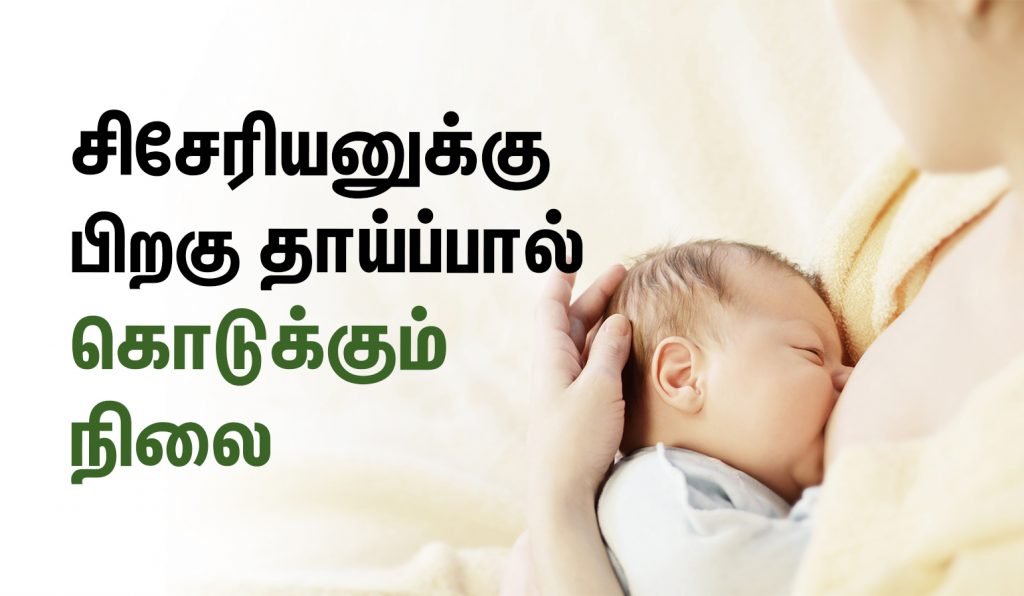 சிசேரியனுக்கு பிறகு கவனம் செலுத்த வேண்டிய விஷயங்கள்! (C-Section Recovery in tamil) 5 Breastfeeding After a C-Section