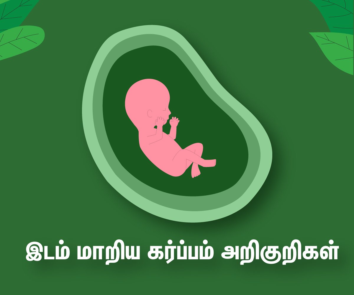 Ectopic Pregnancy Symptoms!