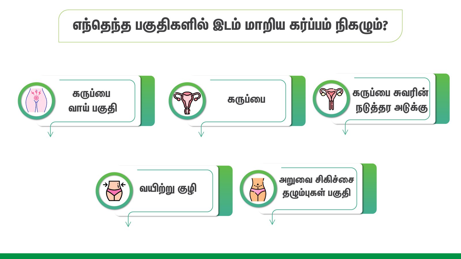 Ectopic pregnancy Information