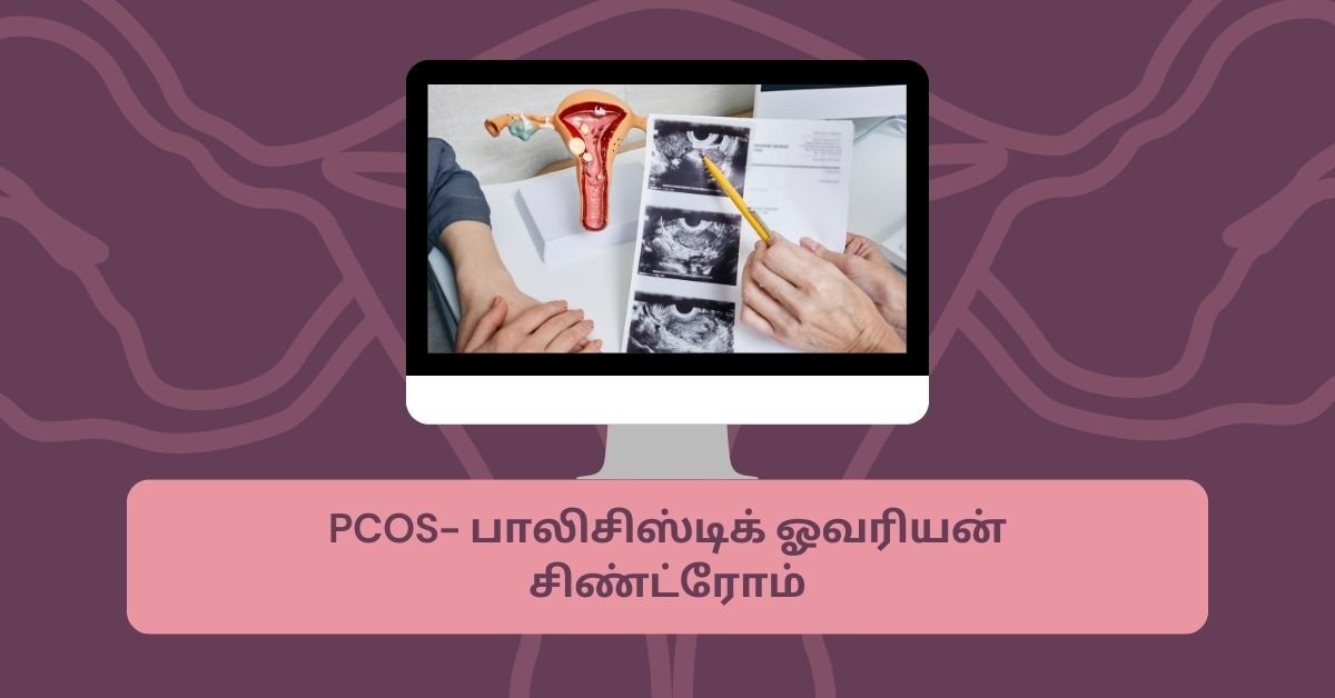 PCOS