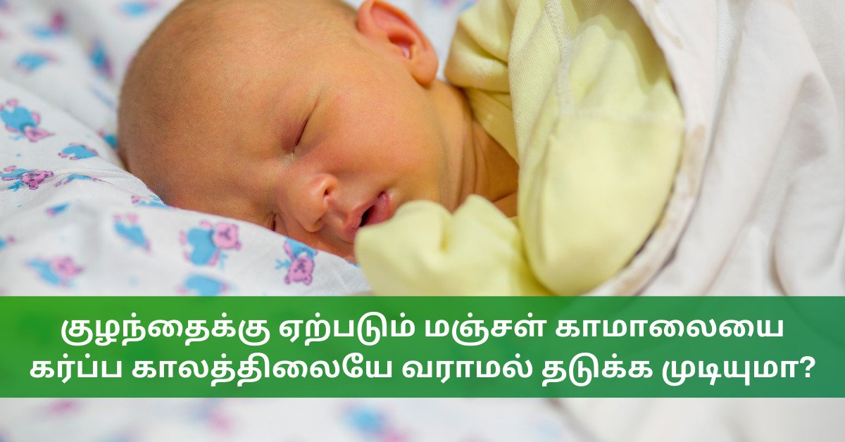 Newborn jaundice