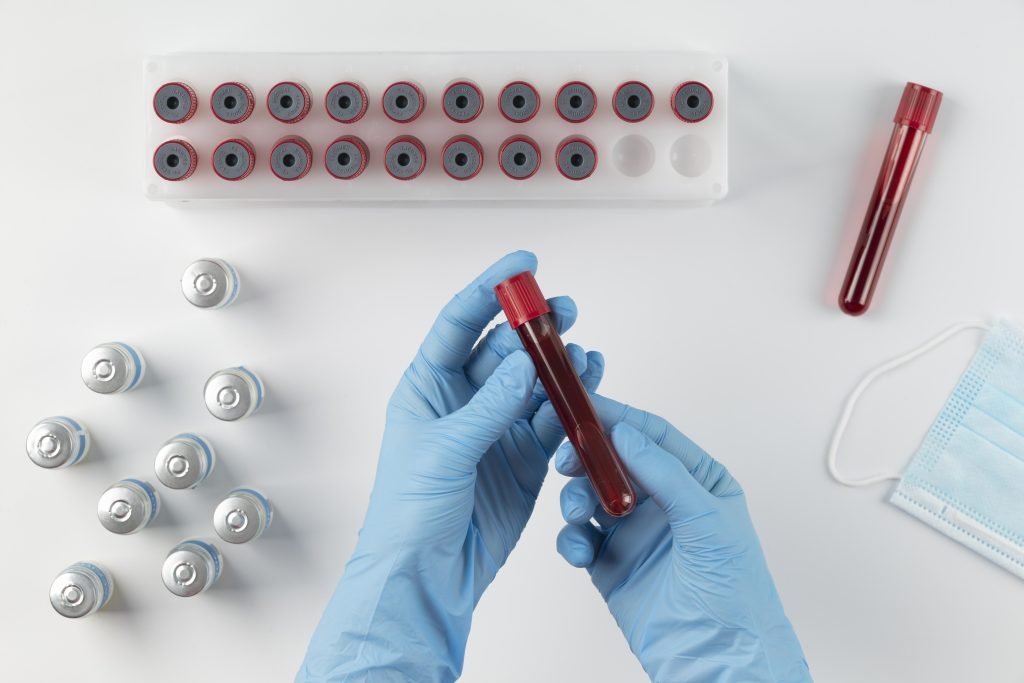 nipt test - service